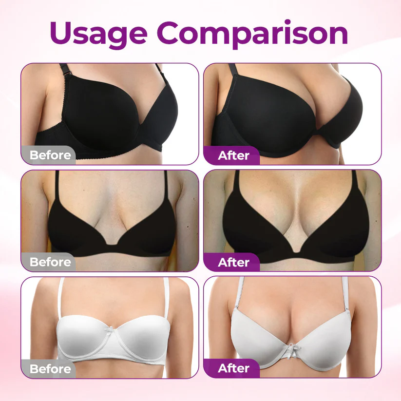 【Official Flagship Store】Slimluxes® Targeted Breast Enhancement Advanced Nano Microneedle Patch