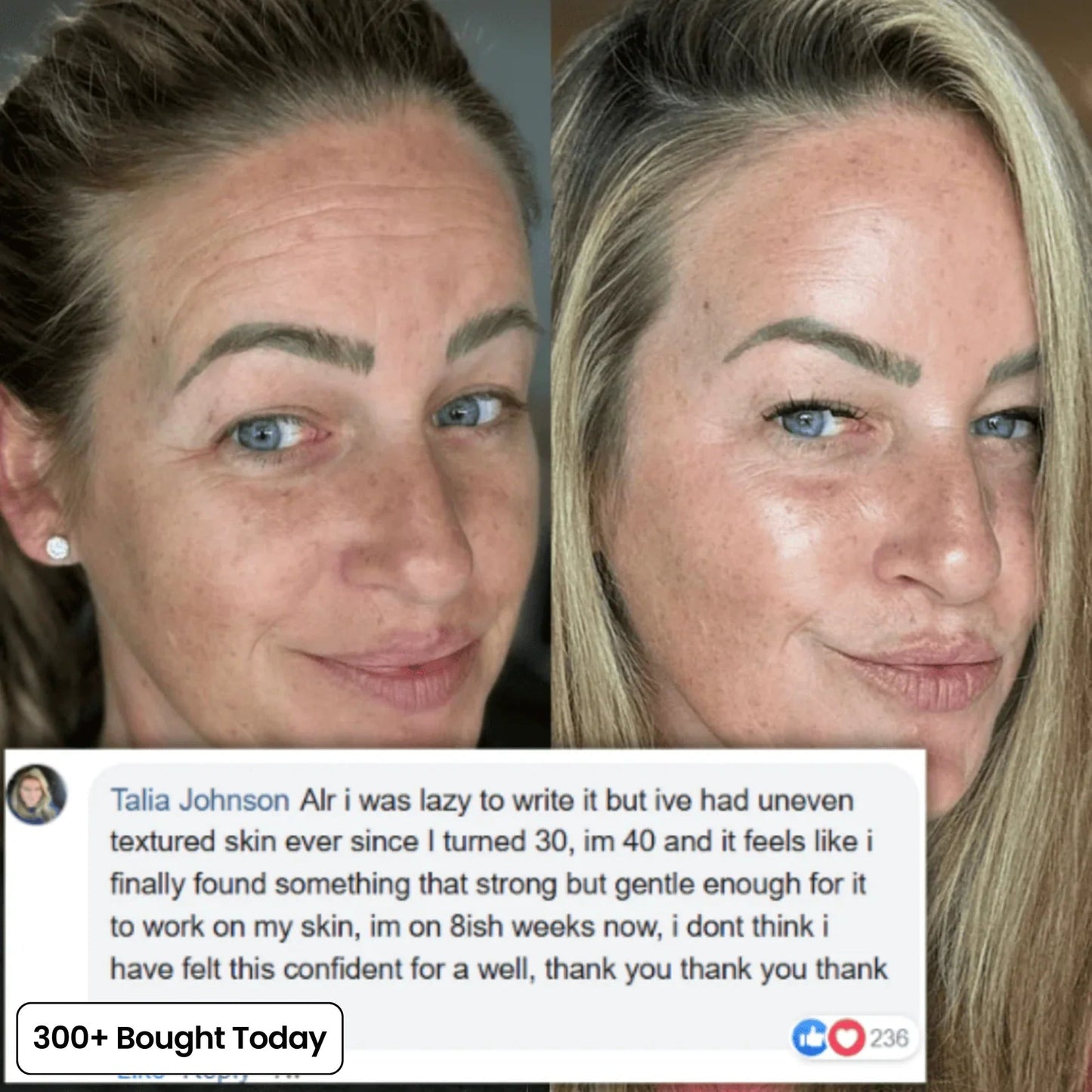 🔥 TODAY’S KLYVENA GLOW DEAL Klyvena Korean Pink Collagen Volume Multi Balm