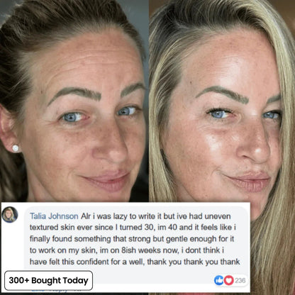 🔥 TODAY’S KLYVENA GLOW DEAL Klyvena Korean Pink Collagen Volume Multi Balm
